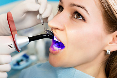 Remmers Dental | Dental Fillings, Teeth Whitening and Sports Mouthguards