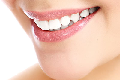 Remmers Dental | Invisalign reg , Teeth Whitening and Preventative Program