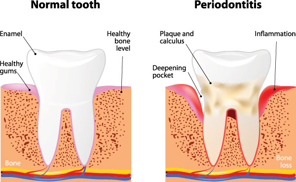 Remmers Dental | CEREC, Implant Dentistry and Dental Fillings