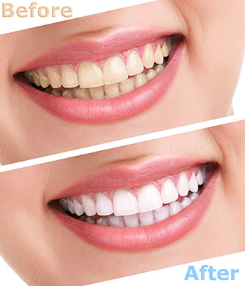 Remmers Dental | Periodontal Treatment, Hybridge Dental Implants and Cosmetic Dentistry